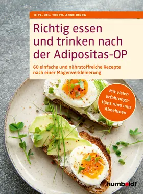 Iburg | Richtig essen und trinken nach der Adipositas-OP | E-Book | sack.de