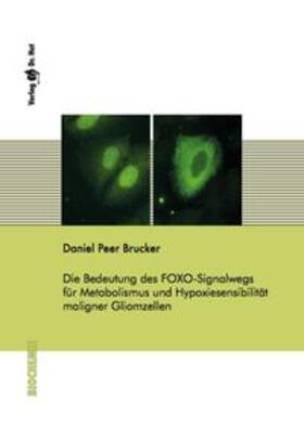 Brucker |  Die Bedeutung des FOXO-Signalwegs für Metabolismus und Hypoxiesensibilität maligner Gliomzellen | Buch |  Sack Fachmedien