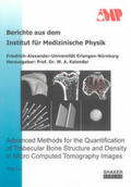 Lu |  Advanced Methods for the Quantification of Trabecular Bone Structure and Density in Micro Computed Tomography Images | Buch |  Sack Fachmedien