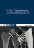 Bätz |  Patientenorientierte Implantation zementfreier Hüftendoprothesen | Buch |  Sack Fachmedien