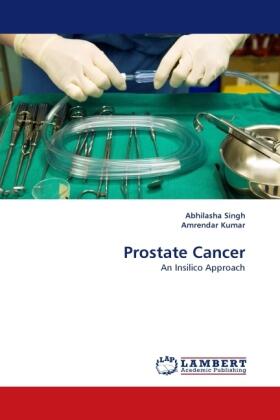 Singh / Kumar |  Prostate Cancer | Buch |  Sack Fachmedien