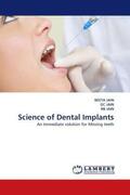 Jain |  Science of Dental Implants | Buch |  Sack Fachmedien