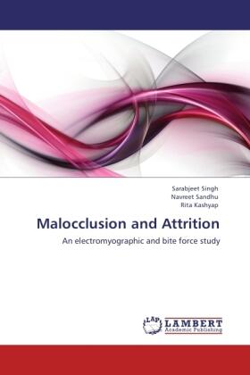 Singh / Sandhu / Kashyap |  Malocclusion and Attrition | Buch |  Sack Fachmedien