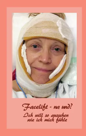Fischer / Siegmund |  Facelift - na und? | eBook | Sack Fachmedien