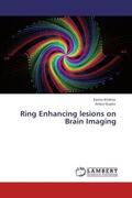 Krishna / Gupta |  Ring Enhancing lesions on Brain Imaging | Buch |  Sack Fachmedien