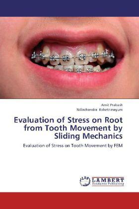 Prakash / Kshetrimayum |  Evaluation of Stress on Root from Tooth Movement by Sliding Mechanics | Buch |  Sack Fachmedien