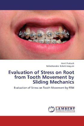 Prakash / Kshetrimayum | Evaluation of Stress on Root from Tooth Movement by Sliding Mechanics | Buch | 978-3-8484-4992-7 | sack.de