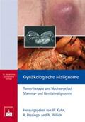 Kuhn / Possinger / Willich |  Gynäkologische Malignome | eBook | Sack Fachmedien