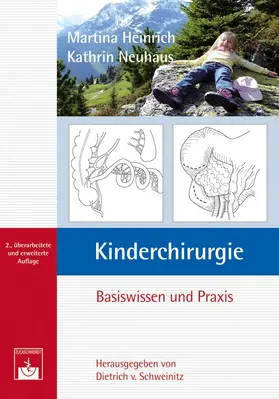 Heinrich / Neuhaus / Schweinitz | Kinderchirurgie | Buch | 978-3-86371-057-6 | www.sack.de