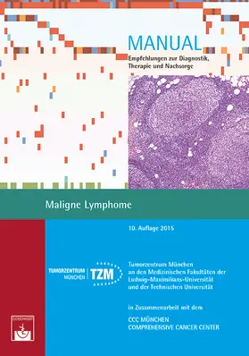Tumorzentrum München / Dreyling | Maligne Lymphome | Buch | 978-3-86371-185-6 | www.sack.de