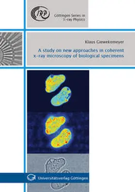 Giewekemeyer |  A study on new approaches in coherent x-ray microscopy of biological specimens | Buch |  Sack Fachmedien