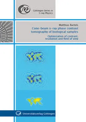 Bartels |  Cone-beam x-ray phase contrast tomography of biological samples | Buch |  Sack Fachmedien