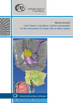 Krenkel |  Cone-beam x-ray phase-contrast tomography for the observation of single cells in whole organs | Buch |  Sack Fachmedien