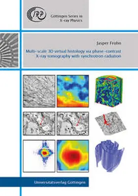 Frohn |  Multi-scale 3D virtual histology via phase-contrast X-ray tomography with synchrotron radiation | Buch |  Sack Fachmedien