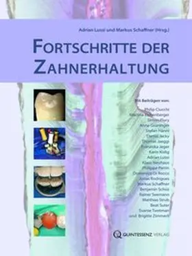 Lussi / Schaffner |  Fortschritte der Zahnerhaltung | Buch |  Sack Fachmedien