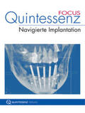 Hopp / Stachulla |  Quintessenz FOCUS Navigierte Implantation | Buch |  Sack Fachmedien