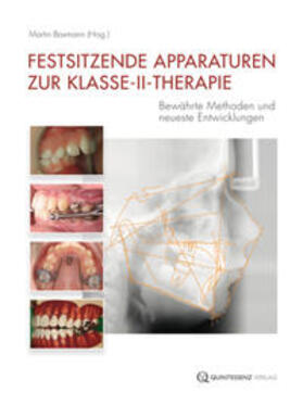 Baxmann |  Festsitzende Apparaturen zur Klasse-II-Therapie | Buch |  Sack Fachmedien