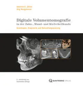 Neugebauer / Zöller | Zöller: Digitale Volumentomografie Zahn-/Mund-/Kieferheilk. | Buch | 978-3-86867-052-3 | sack.de
