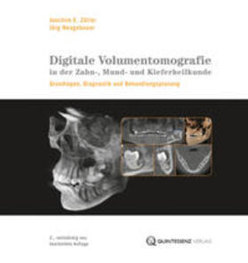 Zöller / Neugebauer | Zöller: Digitale Volumentomografie Zahn-/Mund-/Kieferheilk. | Buch | 978-3-86867-052-3 | sack.de