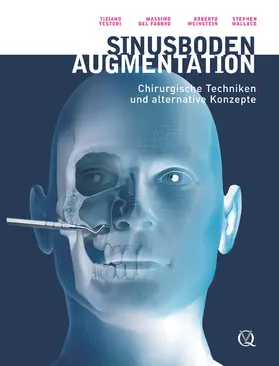 Testori / Fabbro / Weinstein |  Sinusbodenaugmentation | eBook | Sack Fachmedien