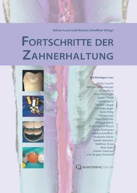 Lussi / Schaffner |  Fortschritte der Zahnerhaltung | eBook | Sack Fachmedien