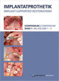 Ackermann / Beuer / Happe |  Implantatprothetik. DVD-Kompendium | Sonstiges |  Sack Fachmedien