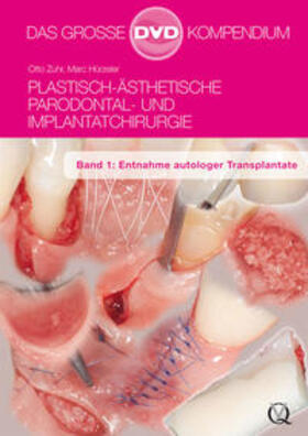 Zuhr / Hürzeler | Plastisch-Ästhetische Parodontal- und Implantatchirurgie | Sonstiges | 978-3-86867-146-9 | sack.de