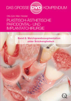Zuhr / Hürzeler | Plastisch-Ästhetische Parodontal- und Implantatchirurgie | Sonstiges | 978-3-86867-153-7 | sack.de