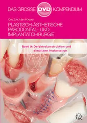 Zuhr / Hürzeler |  Plastisch-Ästhetische Parodontal- und Implantatchirurgie | Sonstiges |  Sack Fachmedien