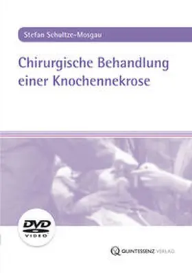 Schultze-Mosgau |  Chirurgische Behandlung einer Knochennekrose | Sonstiges |  Sack Fachmedien