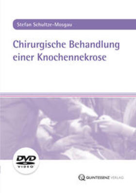 Schultze-Mosgau | Chirurgische Behandlung einer Knochennekrose, DVD-Video | Sonstiges | 978-3-86867-201-5 | sack.de