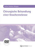 Schultze-Mosgau |  Chirurgische Behandlung einer Knochennekrose, DVD-Video | Sonstiges |  Sack Fachmedien