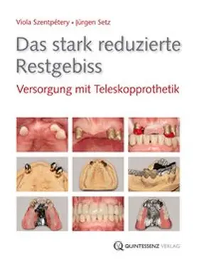 Szentpétery / Setz |  Das stark reduzierte Restgebiss | Buch |  Sack Fachmedien