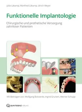 Läkamp / Meyer |  Funktionelle Implantologie | Buch |  Sack Fachmedien