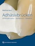 Kern |  Adhäsivbrücken | Buch |  Sack Fachmedien
