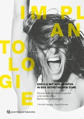 Happe / Körner |  Erfolg mit Implantaten in der ästhetischen Zone | Buch |  Sack Fachmedien