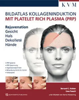 Paasch / Kolster |  Bildatlas Kollageninduktion mit Platelet Rich Plasma (PRP) | Buch |  Sack Fachmedien