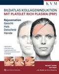 Paasch / Kolster |  Bildatlas Kollageninduktion mit Platelet Rich Plasma (PRP) | Buch |  Sack Fachmedien