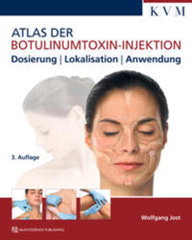 Jost | Atlas der Botulinumtoxin-Injektion | Buch | 978-3-86867-384-5 | sack.de