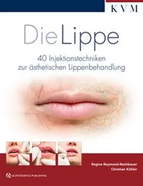 Reymond / Köhler | Die Lippe | Buch | 978-3-86867-402-6 | www.sack.de
