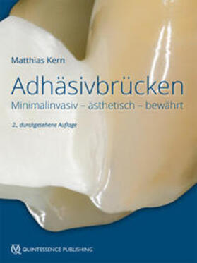 Kern | Adhäsivbrücken | Buch | 978-3-86867-412-5 | sack.de