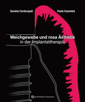 Cardaropoli / Casentini |  Weichgewebe und rosa Ästhetik in der Implantattherapie | Buch |  Sack Fachmedien