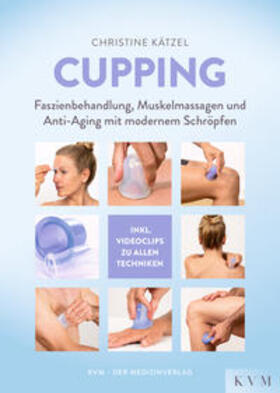 Kätzel | Cupping | Buch | 978-3-86867-485-9 | sack.de