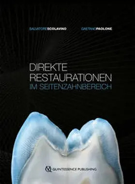 Scolavino / Paolone | Direkte Restaurationen im Seitenzahnbereich | Buch | 978-3-86867-506-1 | www.sack.de