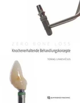 Linkevicius / Linkevicius |  Zero Bone Loss: Knochenerhaltende Behandlungskonzepte | Buch |  Sack Fachmedien