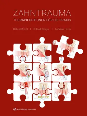 Krastl / Weiger / Filippi |  Zahntrauma | eBook | Sack Fachmedien