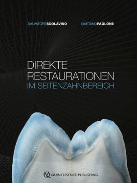 Scolavino / Paolone | Direkte Restaurationen im Seitenzahnbereich | E-Book | sack.de