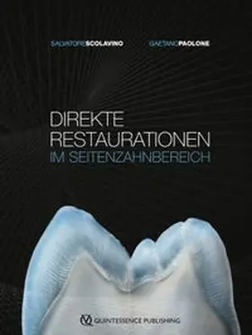 Scolavino / Paolone | Direkte Restaurationen im Seitenzahnbereich | E-Book | www.sack.de