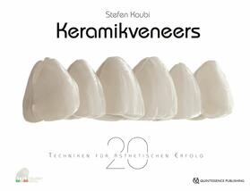 Koubi | Keramikveneers | E-Book | sack.de