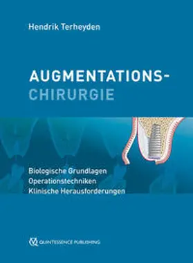 Terheyden | Augmentationschirurgie | Buch | 978-3-86867-548-1 | www.sack.de